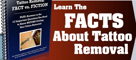 Tattoo Removal Fact vs Fiction