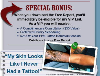 Tattoo Removal Before and After